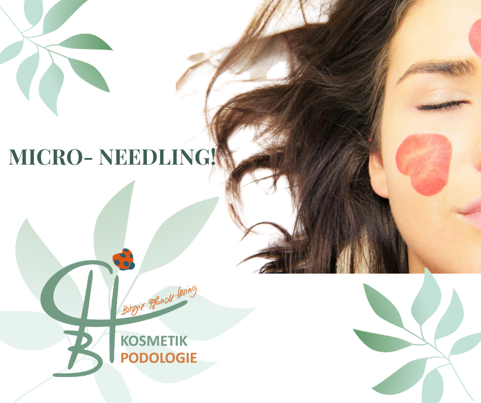 MicroNeedling Behandlung