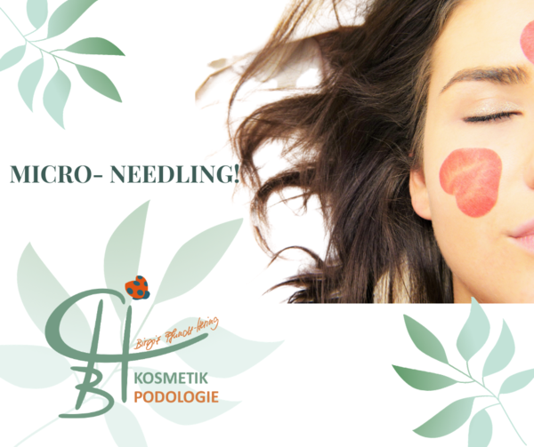 MicroNeedling Behandlung